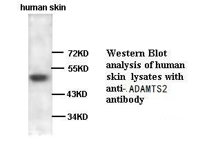ADAMTS2 antibody (pAb)