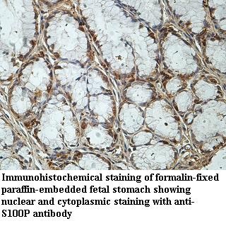 S100P antibody (pAb) S100P antibody (pAb)