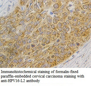 HPV16-L2 antibody (pAb) HPV16-L2 antibody (pAb)
