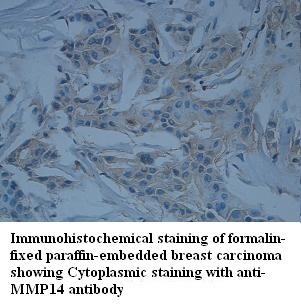 MMP14 antibody (pAb) MMP14 antibody (pAb)