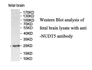 NUDT5 antibody (pAb)