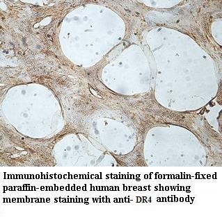 TNFRSF10A antibody (pAb) TNFRSF10A antibody (pAb)