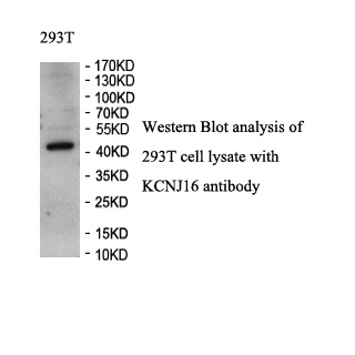 KCNJ16 antibody (pAb) KCNJ16 antibody (pAb)