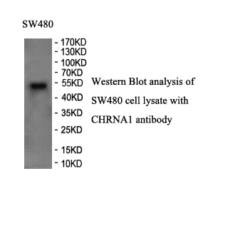 CHRNA1 antibody (pAb) CHRNA1 antibody (pAb)