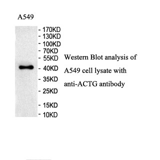 ACTG antibody (pAb)