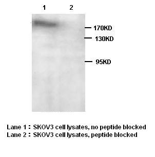 PARP14 antibody (pAb) PARP14 antibody (pAb)