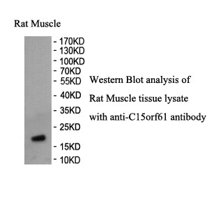 C15orf61 antibody (pAb) C15orf61 antibody (pAb)
