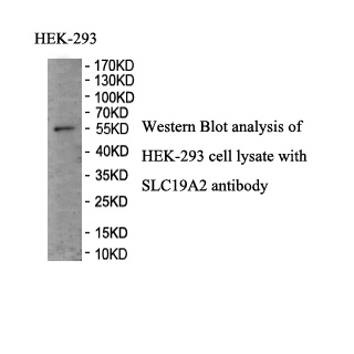 SLC19A2 antibody (pAb) SLC19A2 antibody (pAb)