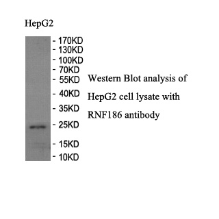 RNF186 antibody (pAb) RNF186 antibody (pAb)