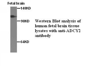 ADCY2 antibody (pAb)