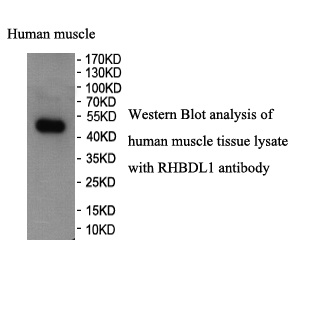 RHBDL1 antibody (pAb) RHBDL1 antibody (pAb)