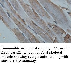 NUDT6 antibody (pAb) NUDT6 antibody (pAb)