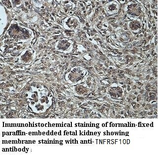 TNFRSF10D antibody (pAb) TNFRSF10D antibody (pAb)