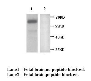 MAGI2 antibody (pAb)