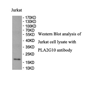 PLA2G10 antibody (pAb) PLA2G10 antibody (pAb)