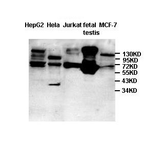 COIL antibody (pAb) COIL antibody (pAb)