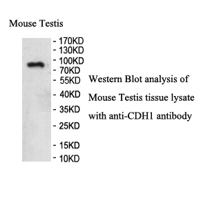 CDH1 antibody (pAb) CDH1 antibody (pAb)