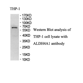 ALDH4A1 antibody (mAb) ALDH4A1 antibody (mAb)