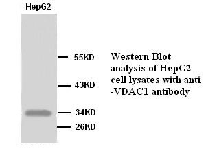 VDAC1 antibody (pAb) VDAC1 antibody (pAb)
