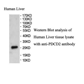 PDCD2 antibody (pAb)