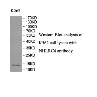 NHLRC4 antibody (pAb) NHLRC4 antibody (pAb)
