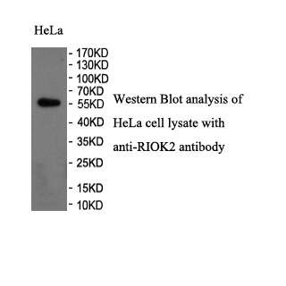 RIOK2 antibody (pAb) RIOK2 antibody (pAb)
