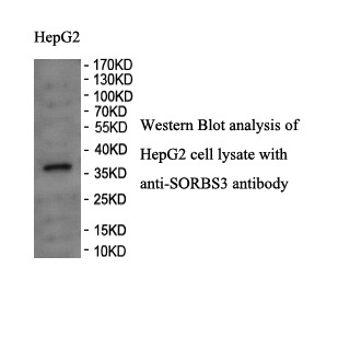 SORBS3 antibody (pAb) SORBS3 antibody (pAb)