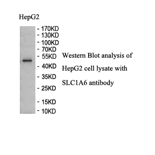 SLC1A6 antibody (pAb) SLC1A6 antibody (pAb)