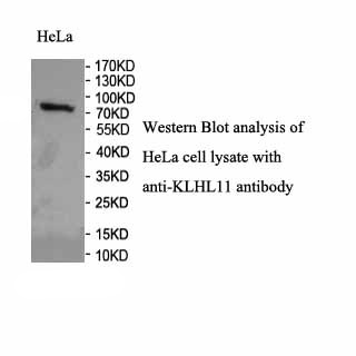KLHL11 antibody (pAb) KLHL11 antibody (pAb)