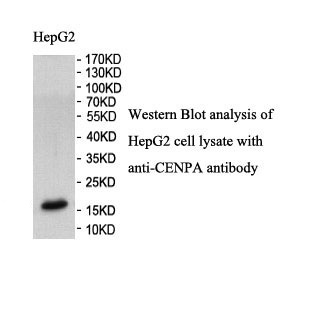 CENPA antibody (pAb)