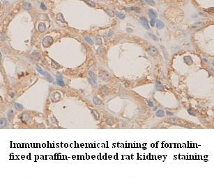 PLXNB1 antibody (pAb) PLXNB1 antibody (pAb)