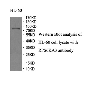 RPS6KA3 antibody (pAb) RPS6KA3 antibody (pAb)