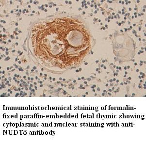 NUDT6 antibody (pAb) NUDT6 antibody (pAb)