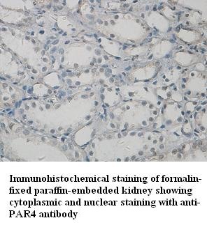 PAWR antibody (pAb) PAWR antibody (pAb)