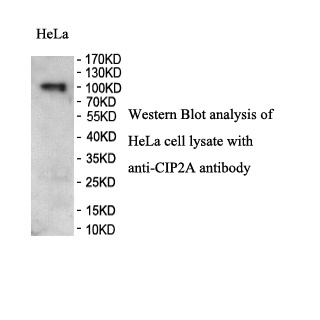CIP2A antibody (pAb)