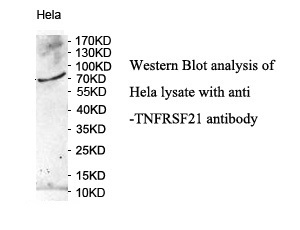 TNFRSF21 antibody (pAb)