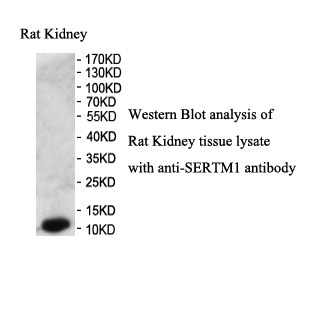 SERTM1 antibody (pAb) SERTM1 antibody (pAb)
