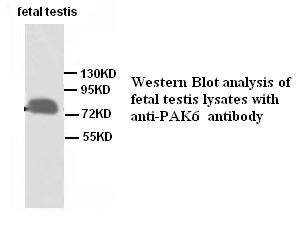 PAK6 antibody (pAb) PAK6 antibody (pAb)