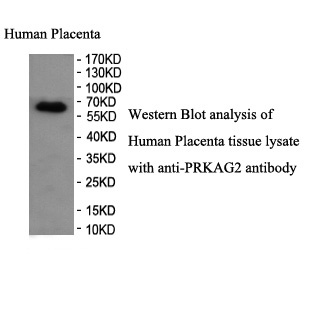 PRKAG2 antibody (pAb)