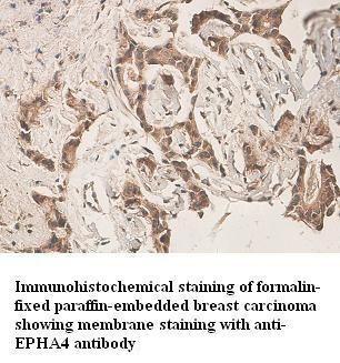 EPHA4 antibody (pAb)