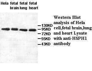 HSPH1 antibody (pAb) HSPH1 antibody (pAb)