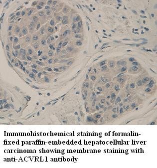 ACVRL1 antibody (pAb)