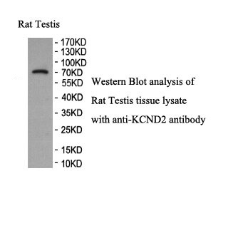 KCND2 antibody (pAb) KCND2 antibody (pAb)