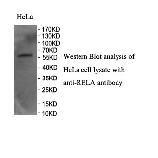 RELA antibody (pAb) RELA antibody (pAb)