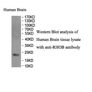 RHOB antibody (pAb) RHOB antibody (pAb)