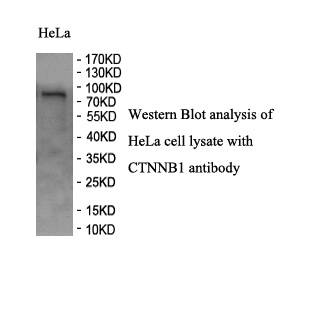 CTNNB1 antibody (pAb) CTNNB1 antibody (pAb)