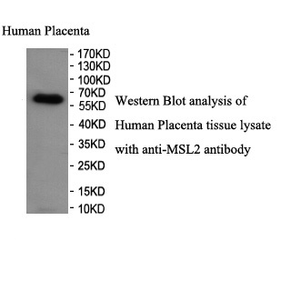 MSL2 antibody (pAb)