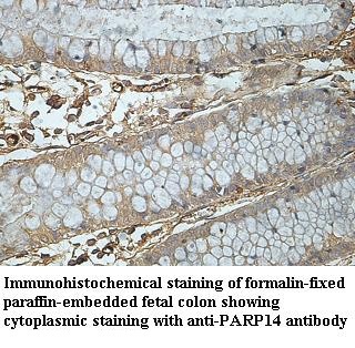 PARP14 antibody (pAb) PARP14 antibody (pAb)