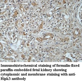 RIPK3 antibody (pAb) RIPK3 antibody (pAb)