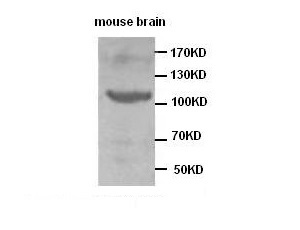 TNK2 antibody (pAb)